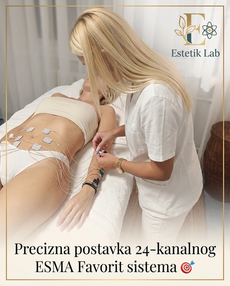 EMS oblikovanje tela – šta je i kome je namenjeno